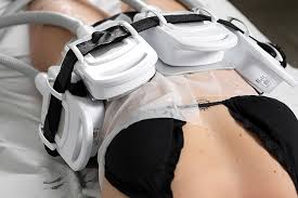 Criolipólise: Redução de Gordura Localizada com Tecnologia e Segurança